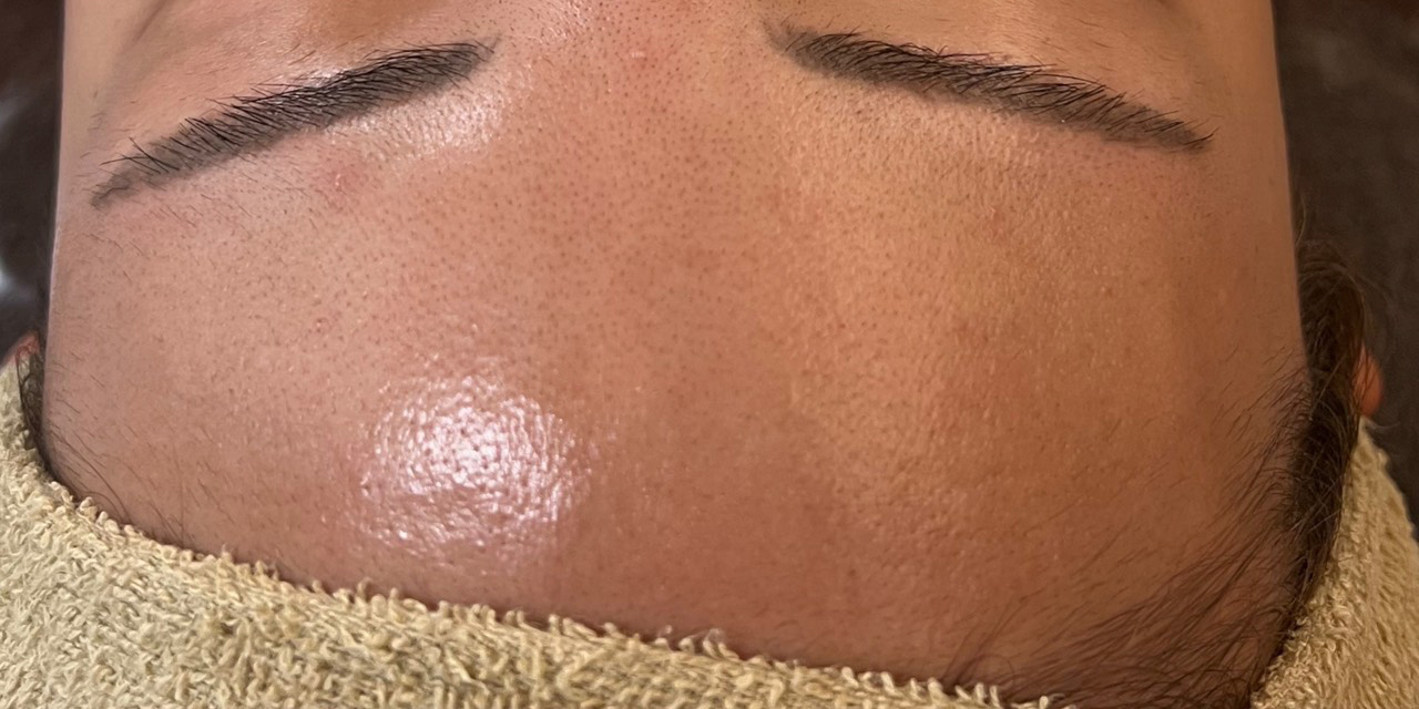 オールハンドフェイシャル施術前